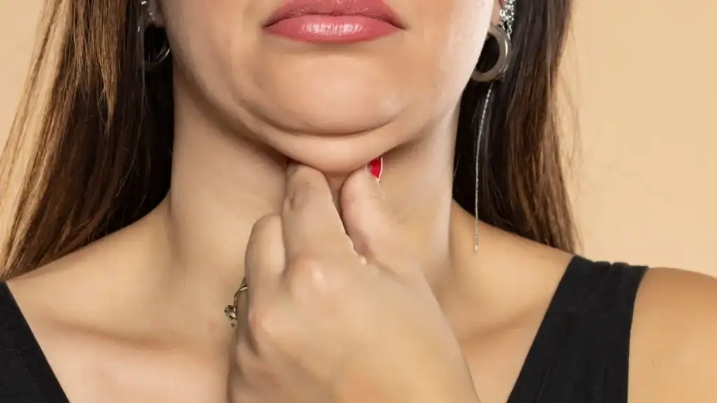 An image of a woman with double chin, sad, worried : Non Surgical Double Chin Removal Treatment in Canterbury, UK