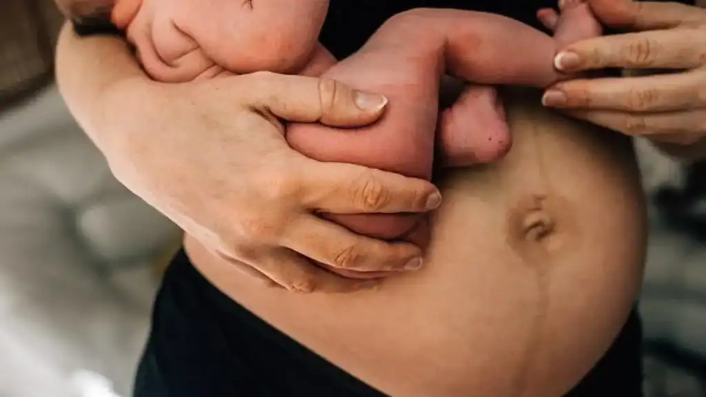 Why Is My Stomach Still Big After Pregnancy Canterbury?